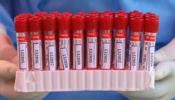 1140 са новите случаи на коронавирус